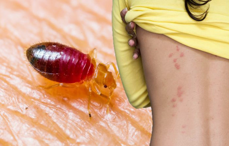 home remedy for bed bugs baking soda